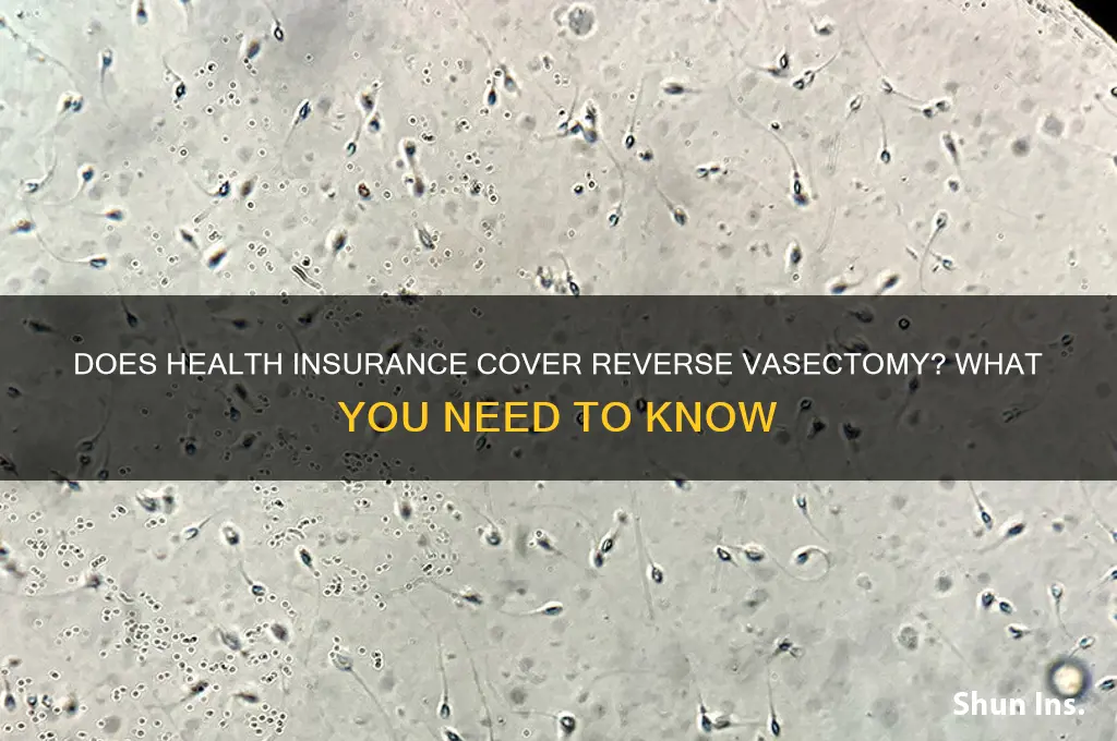 does health insurance cover reverse vasectomy