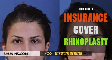 Does Health Insurance Cover Rhinoplasty? What You Need to Know