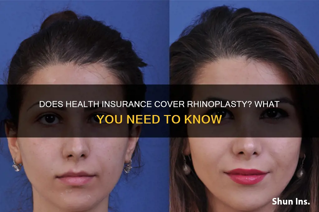 does health insurance cover rhinoplasty