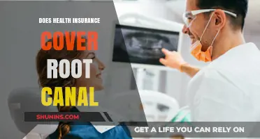 Does Health Insurance Cover Root Canal Treatment? What You Need to Know
