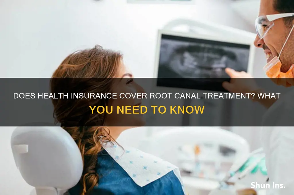 does health insurance cover root canal