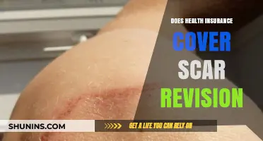Does Health Insurance Cover Scar Revision? What You Need to Know