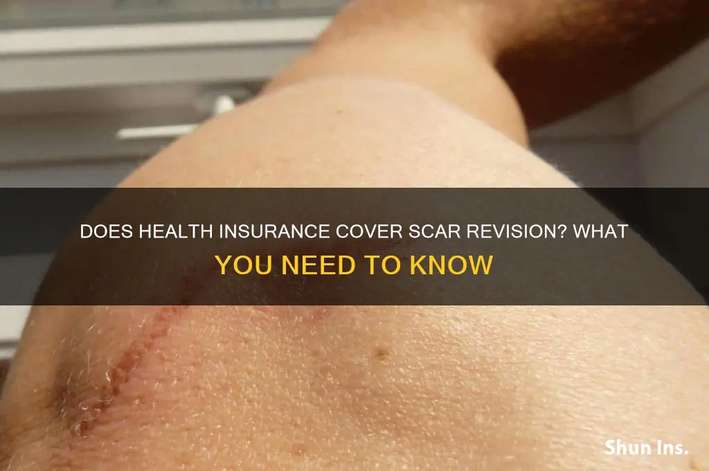 does health insurance cover scar revision