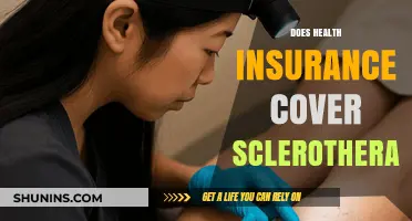 Does Health Insurance Cover Sclerotherapy? What You Need to Know