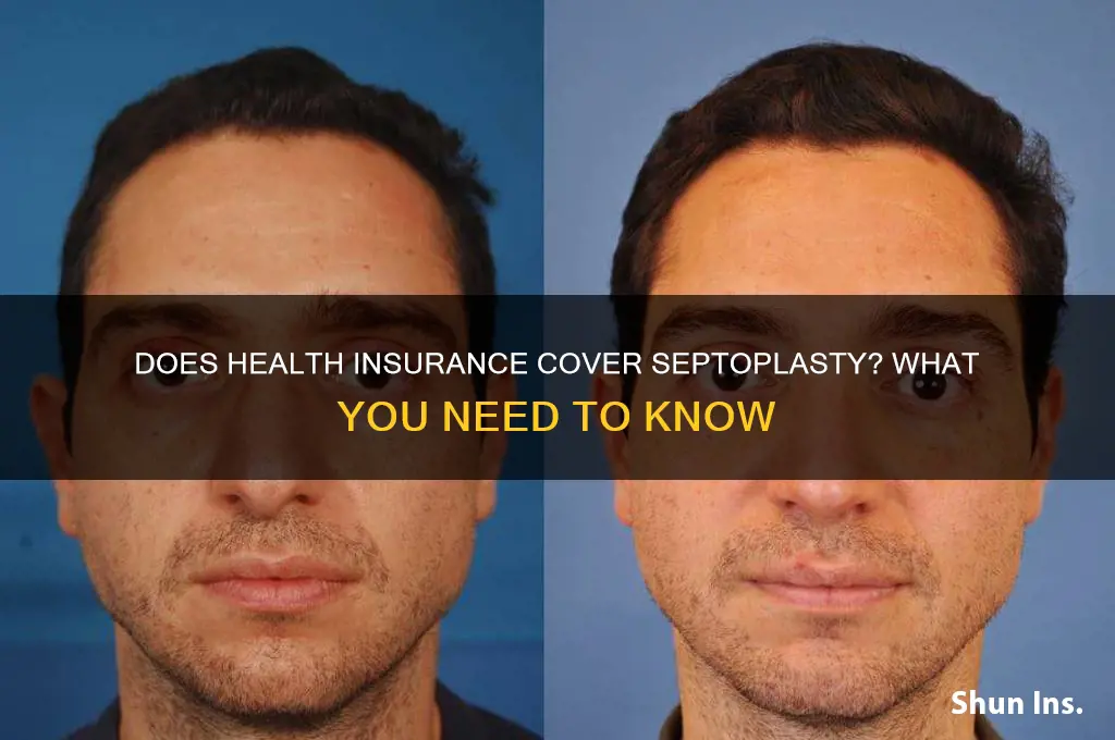 does health insurance cover septoplasty