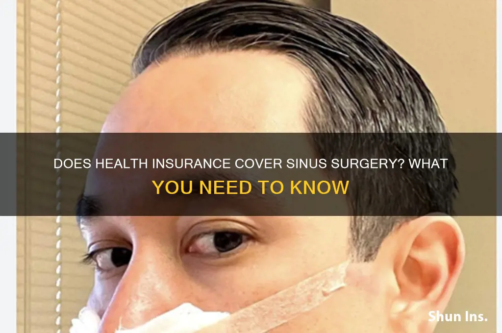 does health insurance cover sinus surgery