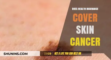 Does Health Insurance Cover Skin Cancer Treatment? What You Need to Know