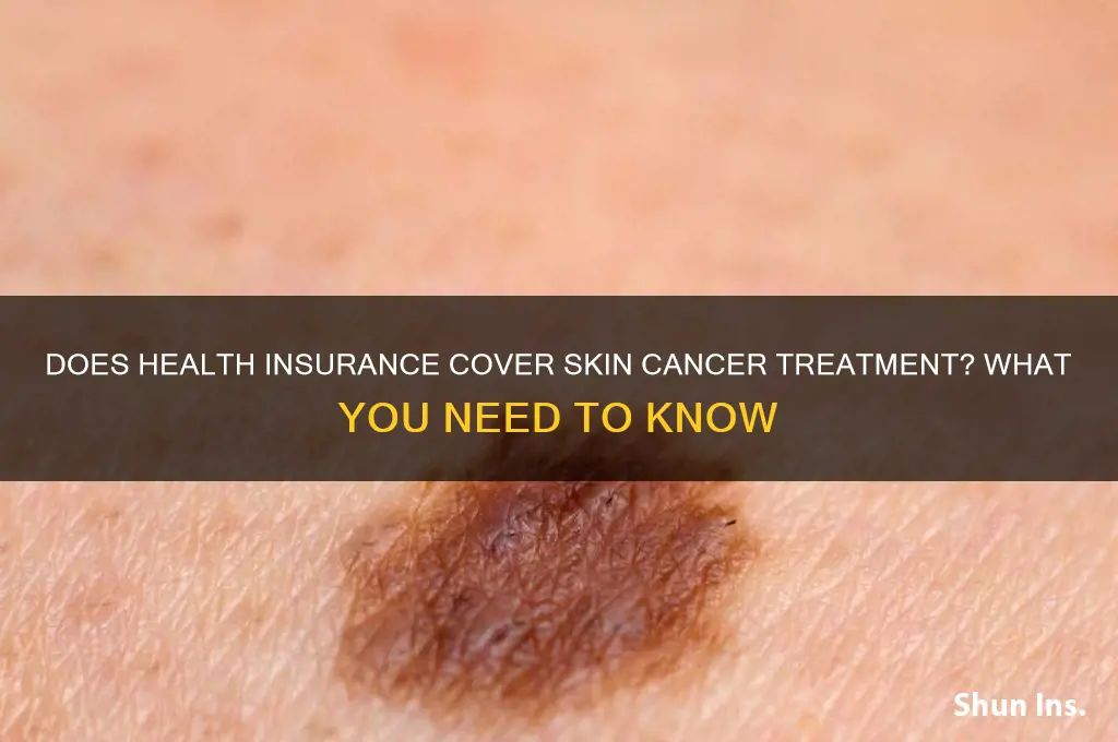 does health insurance cover skin cancer