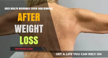 Does Health Insurance Cover Skin Removal After Weight Loss?
