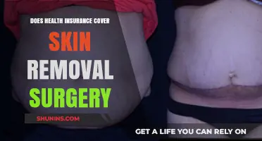Does Health Insurance Cover Skin Removal Surgery? What You Need to Know