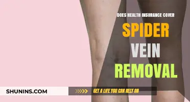Does Health Insurance Cover Spider Vein Removal? What You Need to Know
