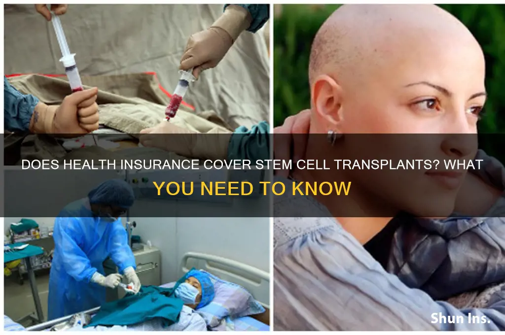 does health insurance cover stem cell transplant