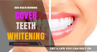 Does Health Insurance Cover Teeth Whitening? What You Need to Know