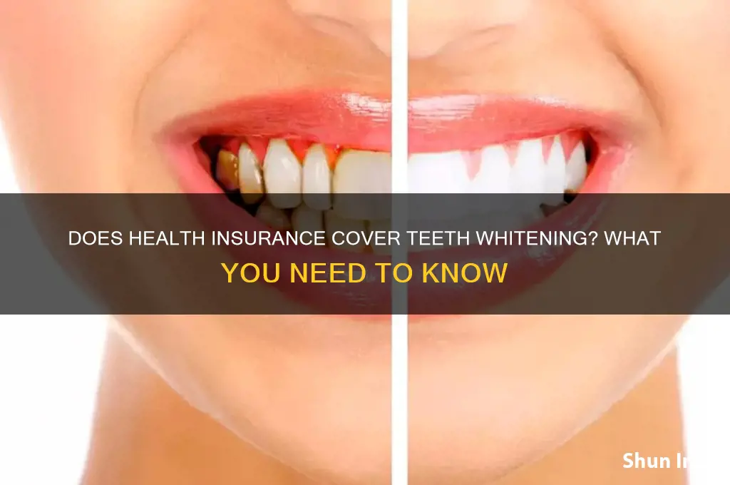 does health insurance cover teeth whitening