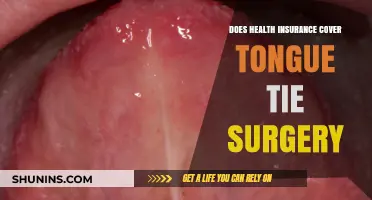 Does Health Insurance Cover Tongue Tie Surgery? What You Need to Know