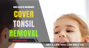 Does Health Insurance Cover Tonsil Removal? What You Need to Know