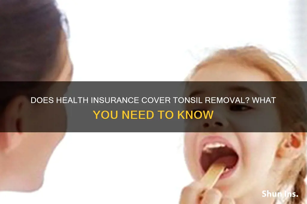 does health insurance cover tonsil removal