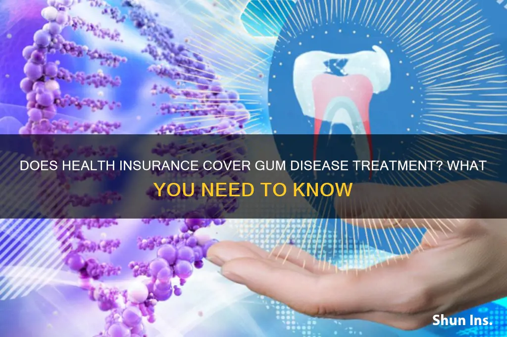 does health insurance cover treatment of gum disease