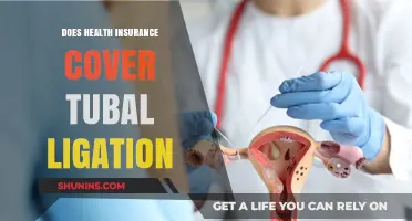 Does Health Insurance Cover Tubal Ligation? What You Need to Know