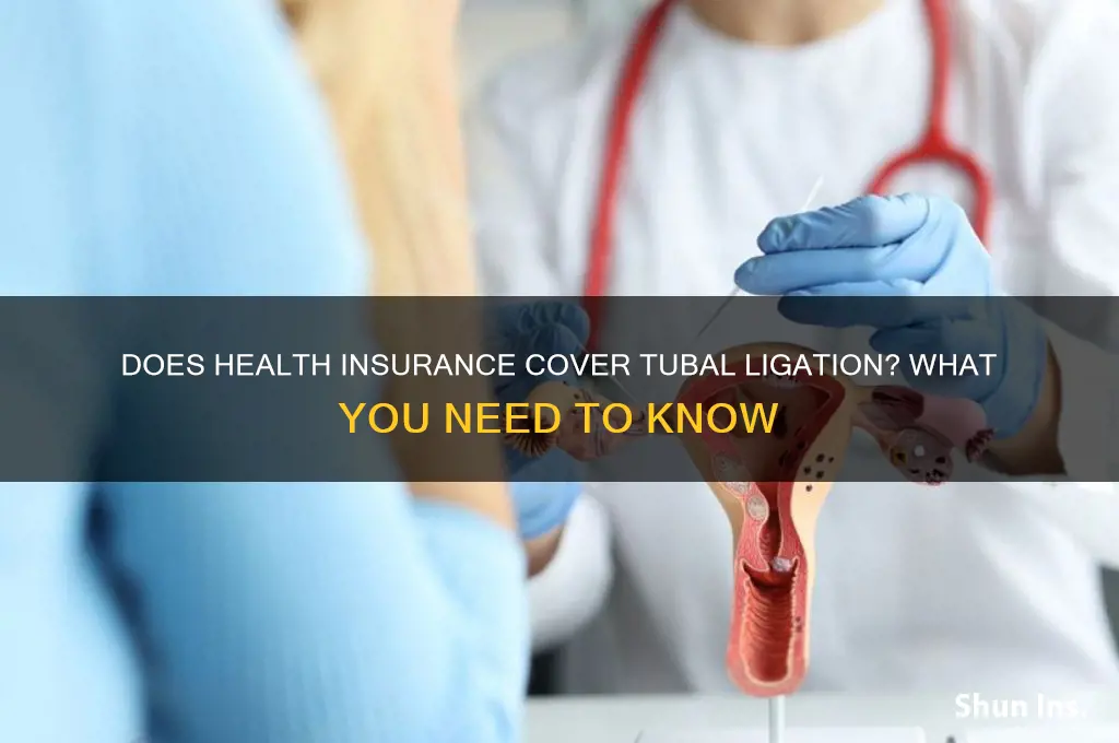 does health insurance cover tubal ligation