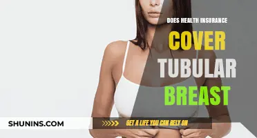 Does Health Insurance Cover Tubular Breast Correction? What to Know