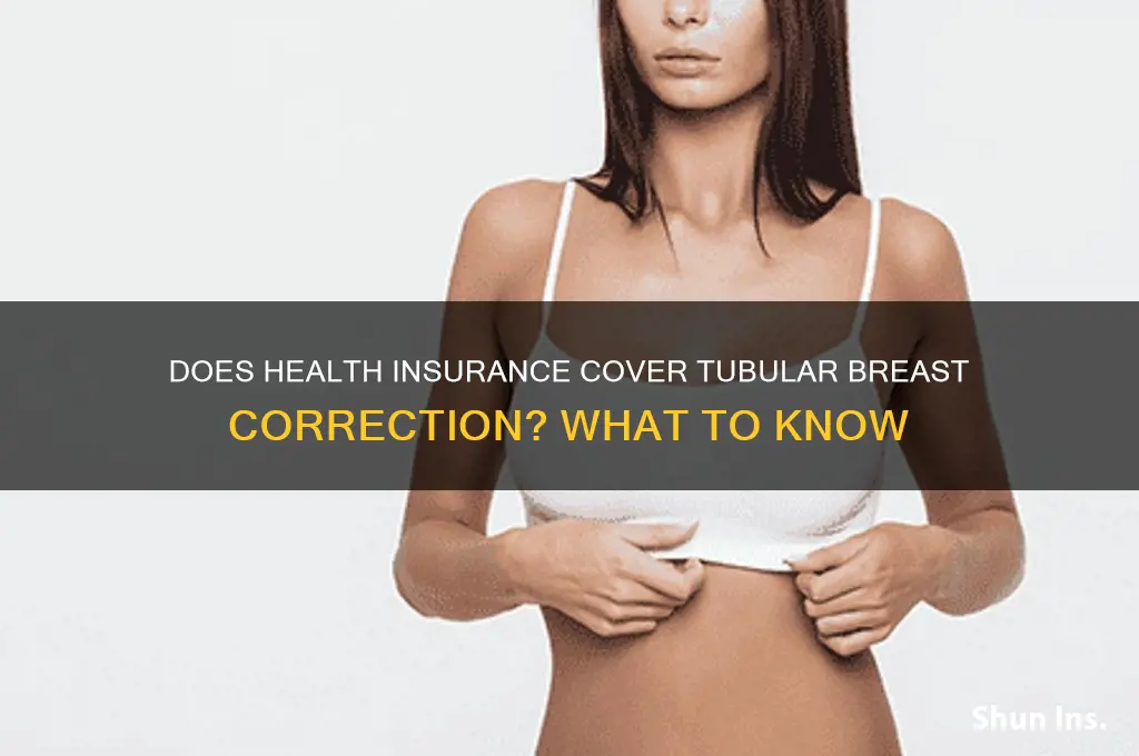 does health insurance cover tubular breast