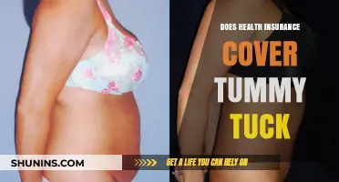 Does Health Insurance Cover Tummy Tuck Procedures? What You Need to Know
