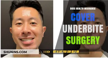 Does Health Insurance Cover Underbite Surgery? What You Need to Know