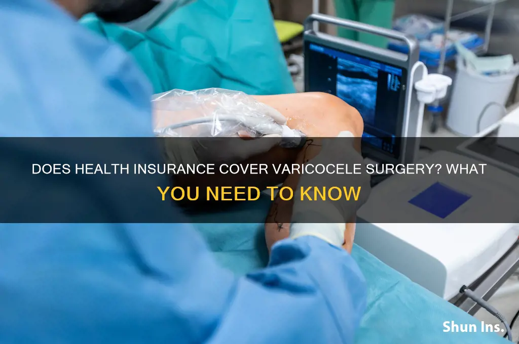 does health insurance cover varicocele surgery