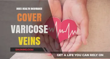Does Health Insurance Cover Varicose Veins? A Comprehensive Guide