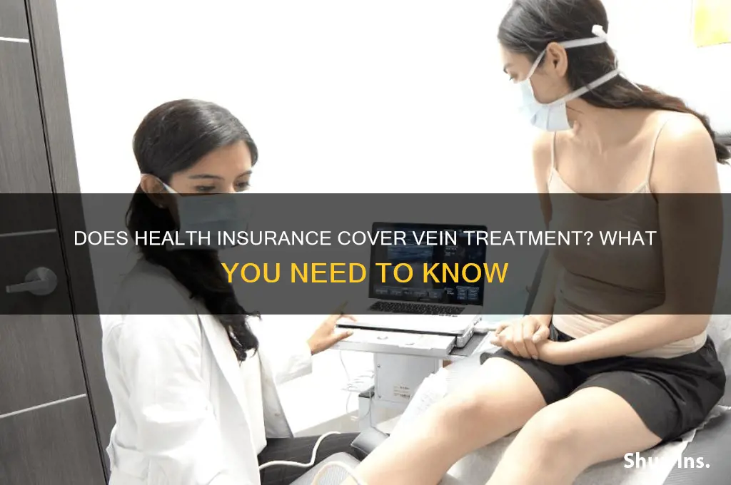 does health insurance cover vein treatment