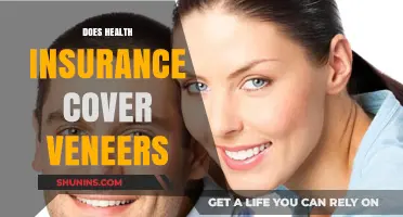 Does Health Insurance Cover Veneers? What You Need to Know