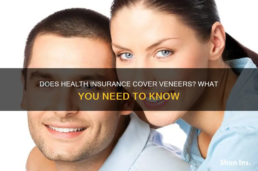does health insurance cover veneers