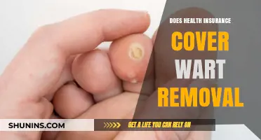 Health Insurance and Wart Removal: What’s Covered and What’s Not?