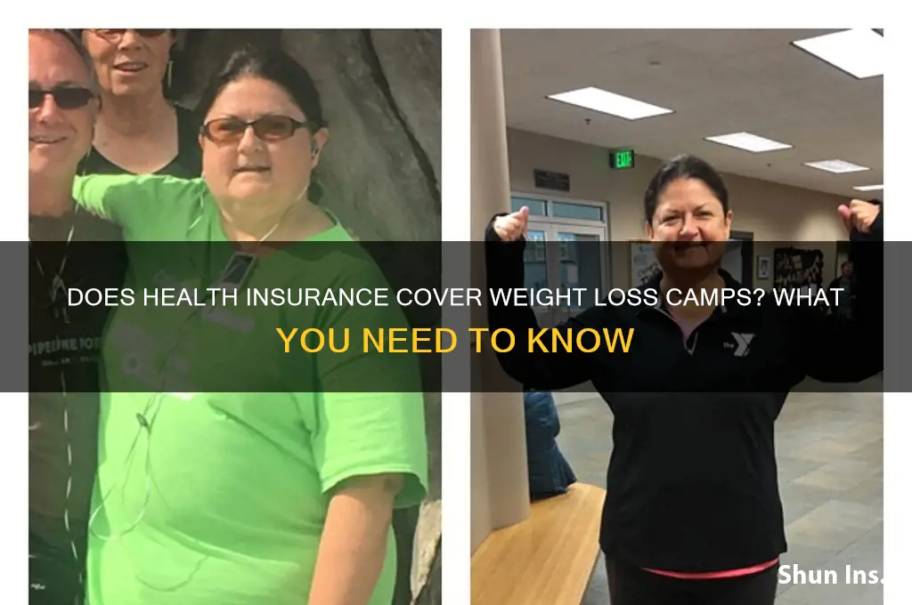 does health insurance cover weight loss camps