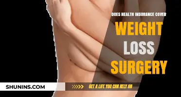 Does Health Insurance Cover Weight Loss Surgery? What You Need to Know