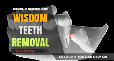 Does Health Insurance Cover Wisdom Teeth Removal? What You Need to Know