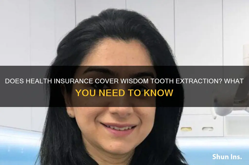does health insurance cover wisdom tooth extraction
