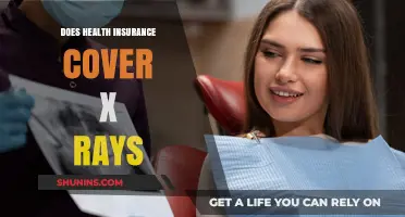 Does Health Insurance Cover X-Rays? Understanding Your Policy Benefits