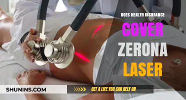 Does Health Insurance Cover Zerona Laser Treatment? What You Need to Know