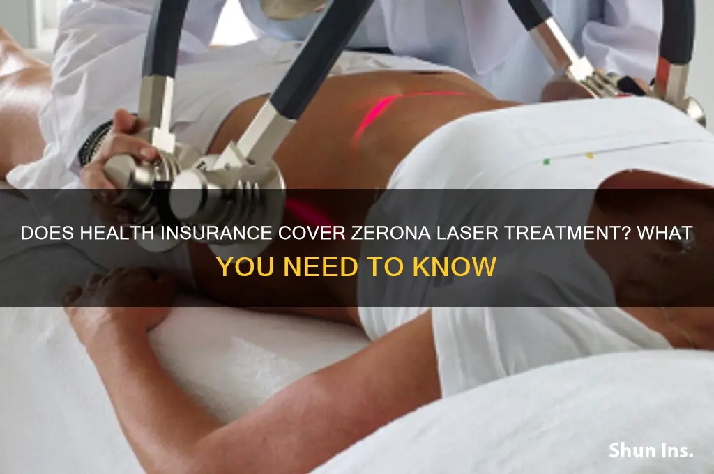 does health insurance cover zerona laser