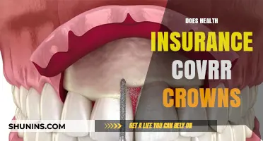 Does Health Insurance Cover Crowns? Understanding Dental Coverage Options