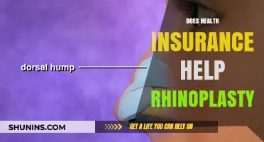 Health Insurance and Rhinoplasty: Coverage, Benefits, and Cost Savings