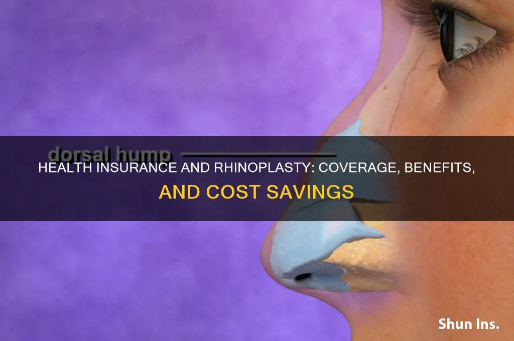 does health insurance help rhinoplasty