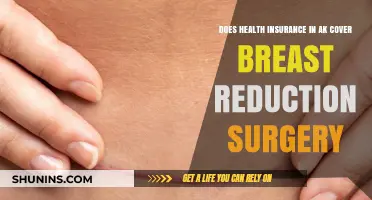 Does Alaska Health Insurance Cover Breast Reduction Surgery?