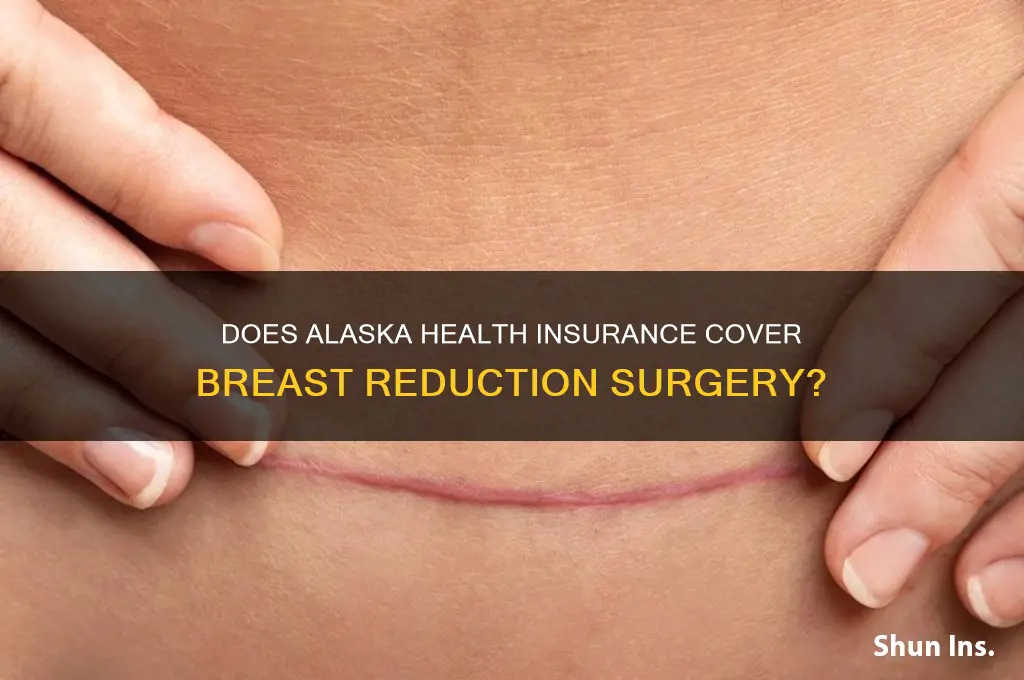 does health insurance in ak cover breast reduction surgery