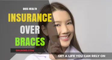 Does Health Insurance Cover Braces? Exploring Orthodontic Coverage Options