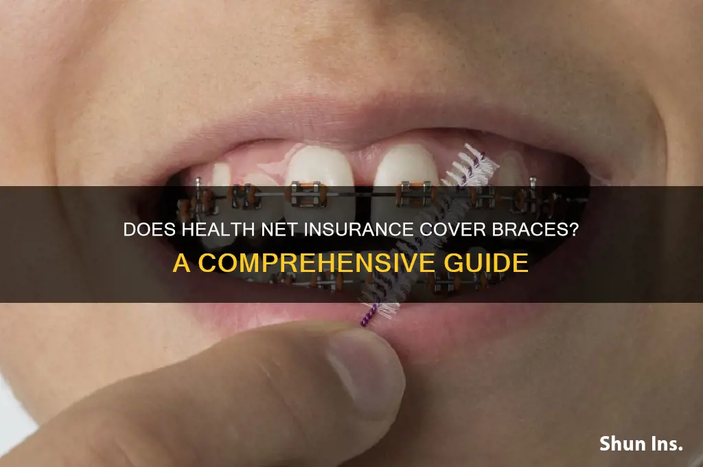 does health net insurance cover braces