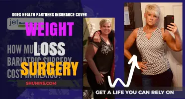 Health Partners Insurance Coverage for Weight Loss Surgery: What You Need to Know