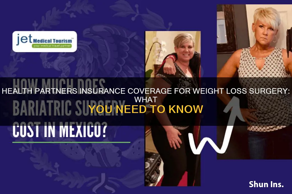 does health partners insurance cover weight loss surgery